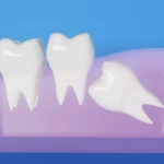 Dental Care